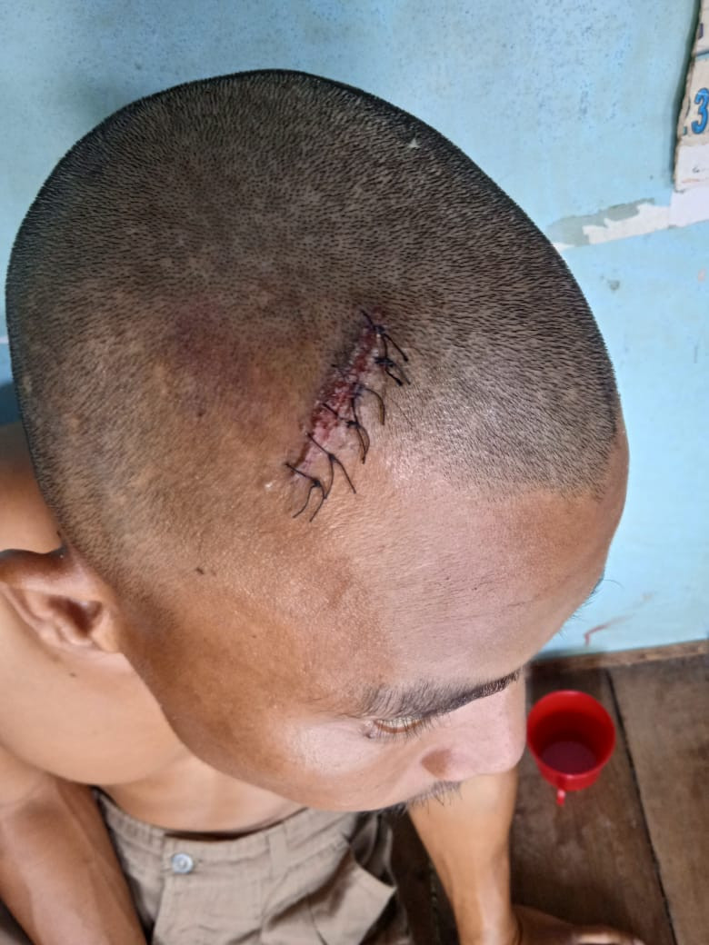 Kepala Robek, Kaki Paha, Tiga Pemuda Dikeroyok, Ini Kronologinya