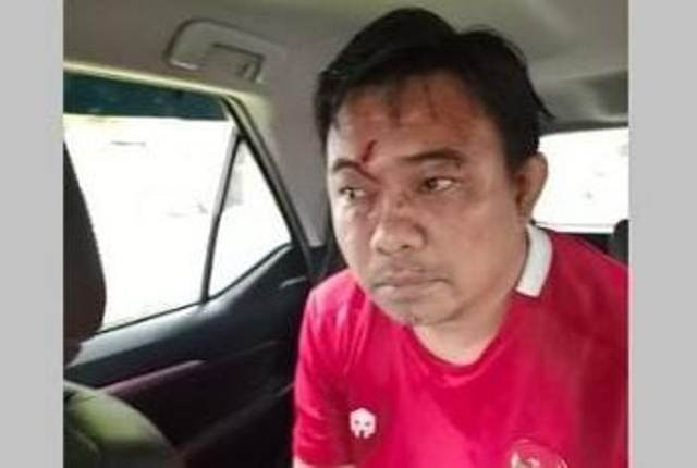 Ketua KNPI Haris Pertama Dilarikan ke RSCM Usai Dikeroyok Sejumlah Orang
